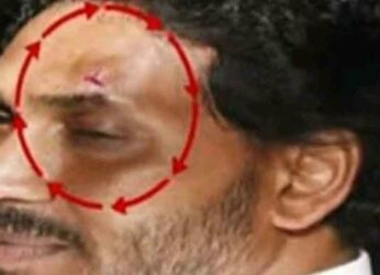 Jagan injured in attack during roadshow in Vijayawada