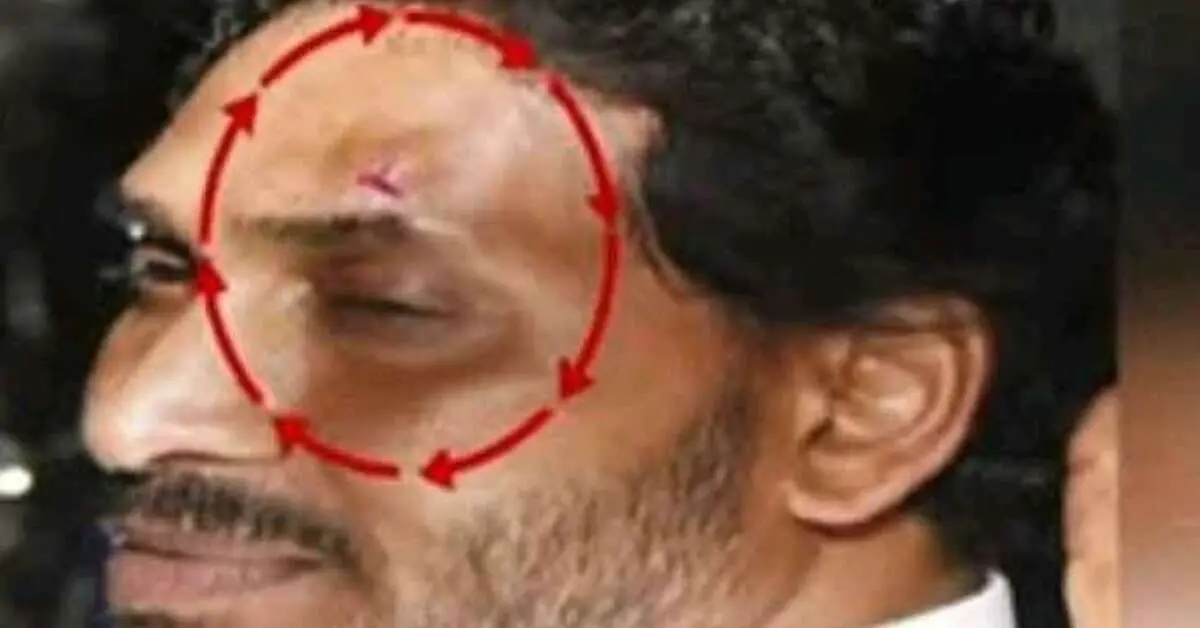 Jagan injured in attack during roadshow in Vijayawada