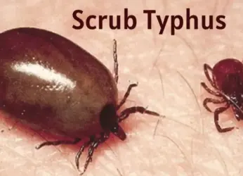 A bite that triggers fear