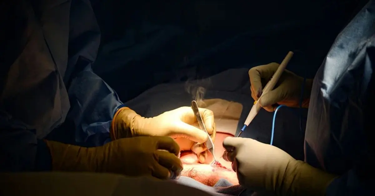 Delicate surgery in Vizag helps two-year-old girl recover her eyesight