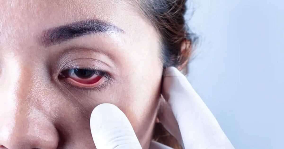 Sankar Foundation Eye Hospital achieves glaucoma milestone